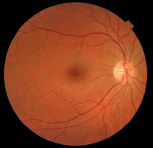 retina red colour