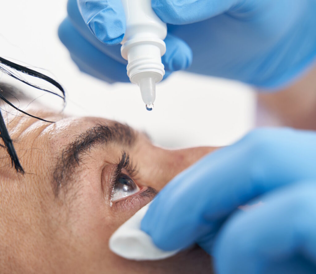 dry eyes patient getting drops