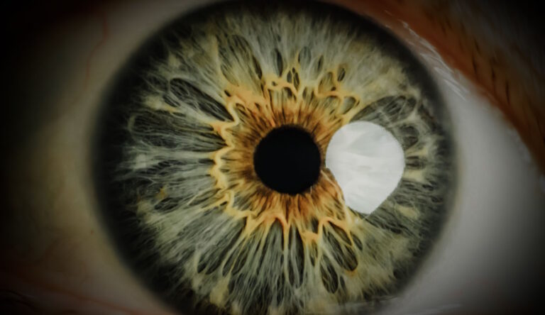 The Iris Function Explained + Anatomy and Common Conditions