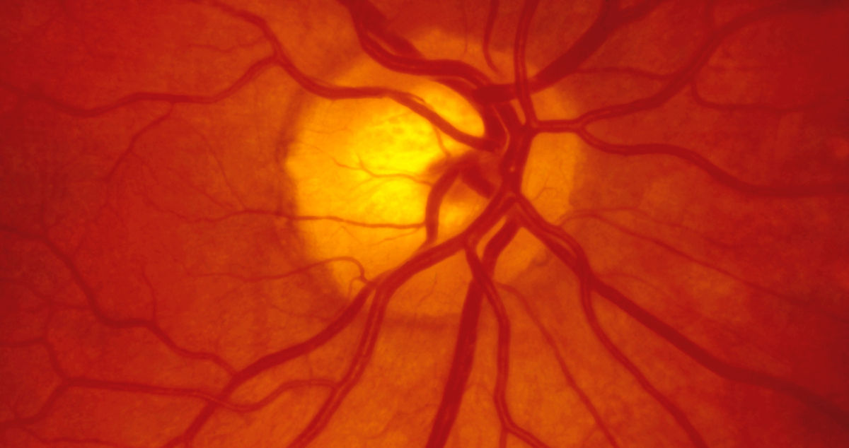 photo of the back of the eye
